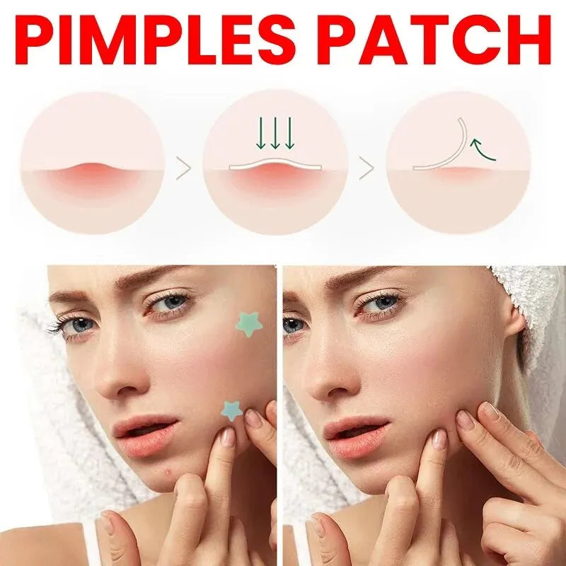 Repair Acne Patch